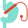 Bariatric Revisional Surgery Icon