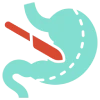 Duodenal Switch Surgery Icon
