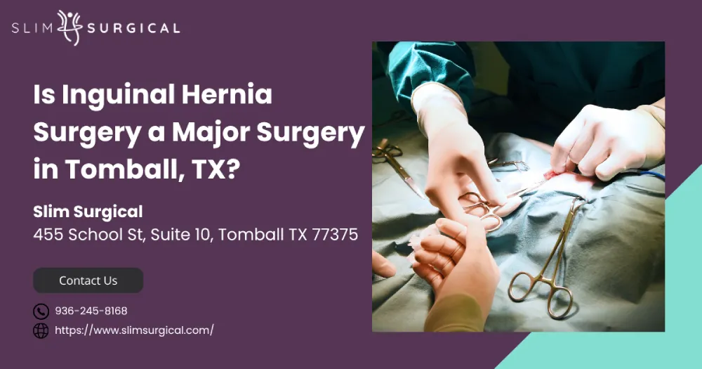 Is Inguinal Hernia Surgery a Major Surgery in Tomball, TX?